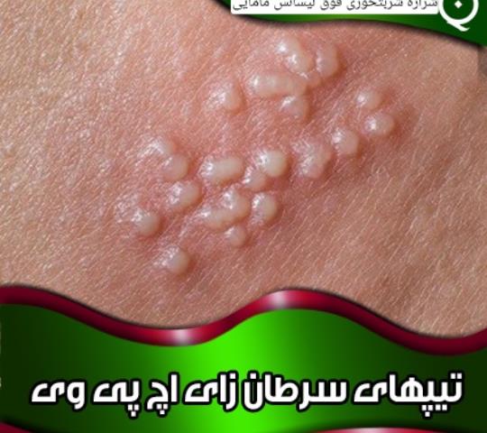 ویروس HPV نوع ۵۲ چیست و چه خطراتی دارد؟