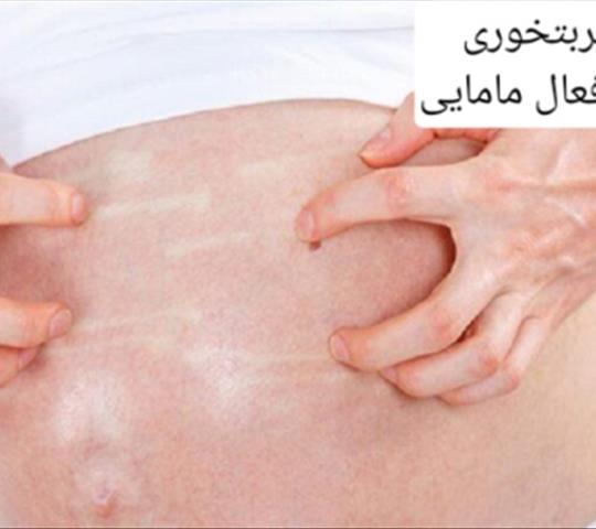 ۶ روش مؤثر برای جلوگیری از ترک شکم در بارداری