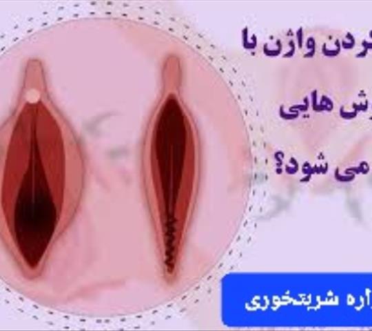 تنگی واژن