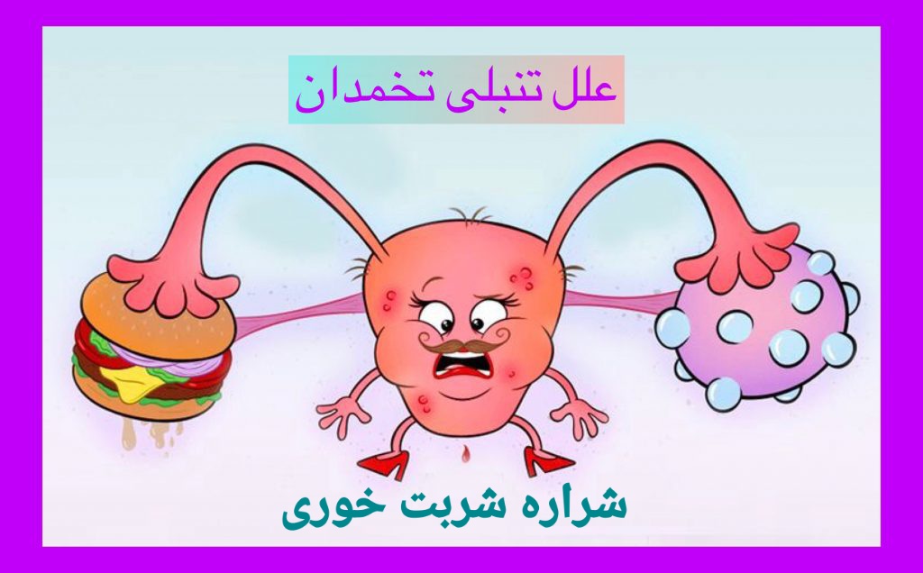 درمان قطعی تنبلی تخمدان