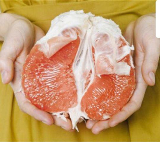 عفونت قارچی واژن چیست؟