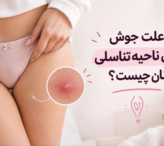 علت جوش روی ناحیه تناسلی زنان چیست؟