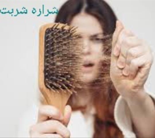ریزش مو زنان