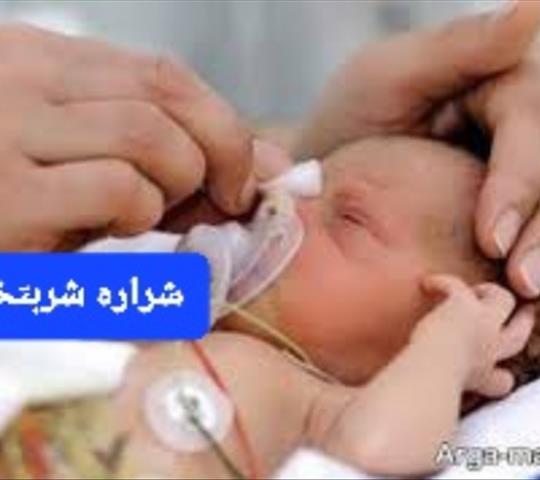عوارض زایمان زودرس  دکتر شراره شربت خوری