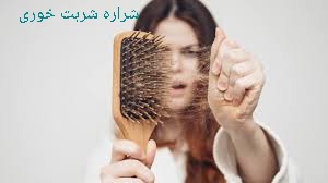 ریزش مو زنان
