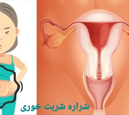 سرطان تخمدان