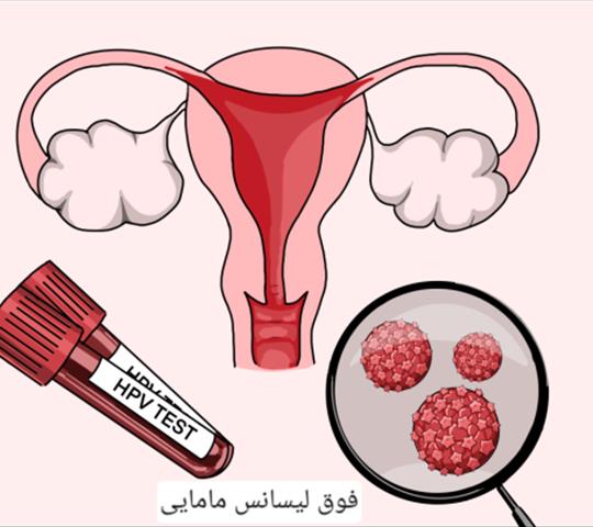 درمان زگیل با لیزر: روشی سریع و مؤثر برای از بین بردن زگیل‌های مقاوم
