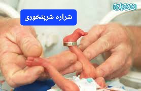 عوارض زایمان زودرس  دکتر شراره شربت خوری